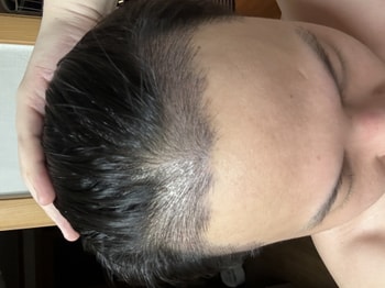 암흑기 오기 전