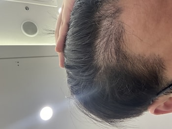 4개월차 현재
