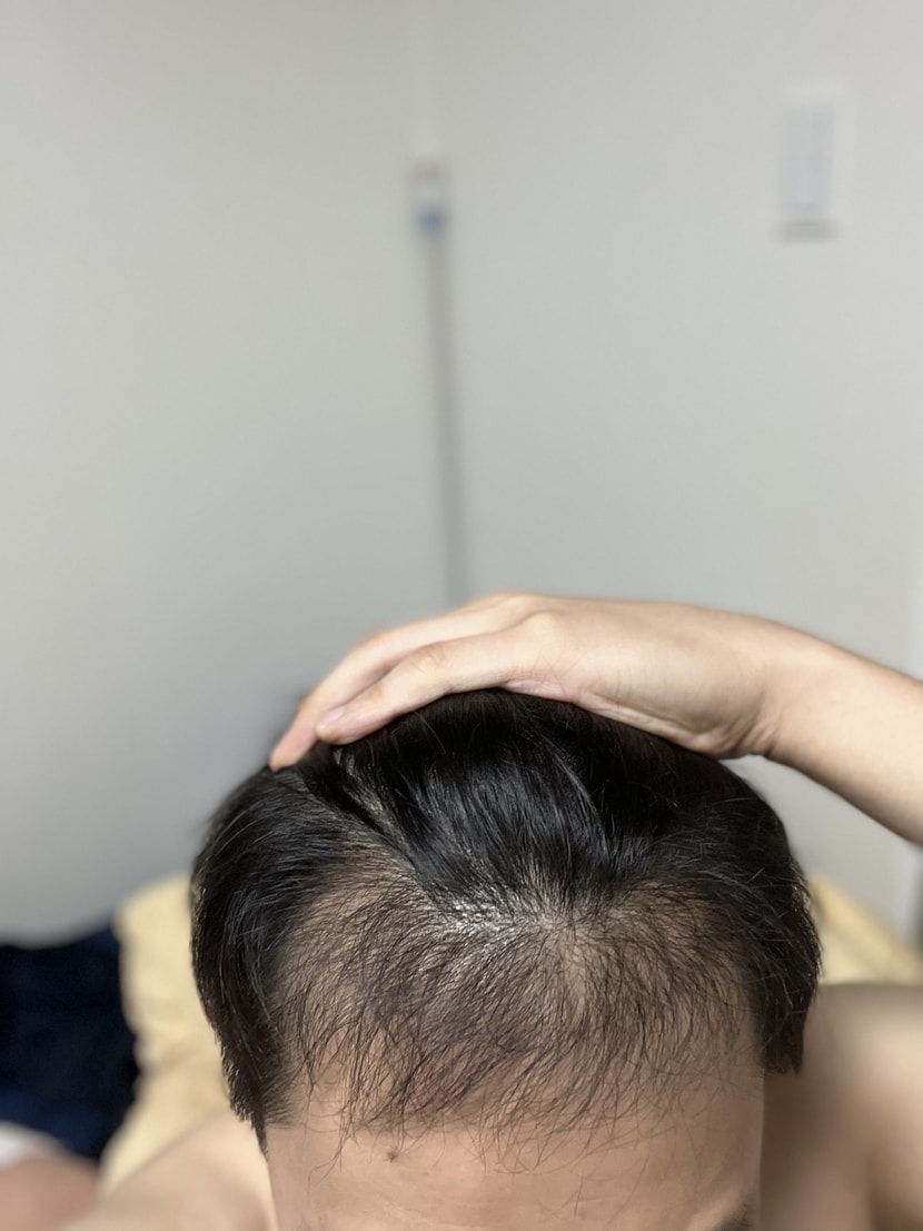 머리카락이 옆으로 꾸불꾸불 돌아가서 내렸어요...
