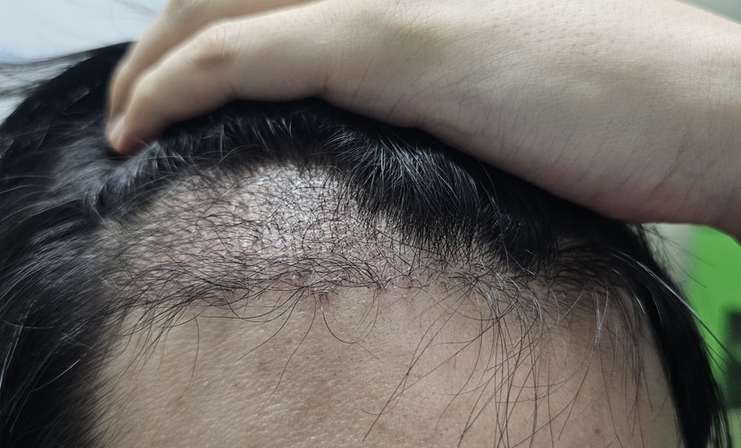 오른쪽