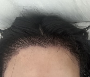 후