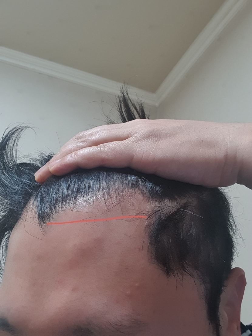 왼쪽엠자사진