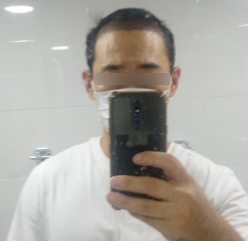 수술후7일차