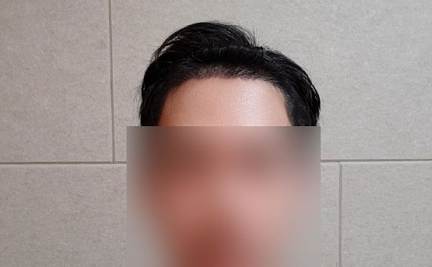 후