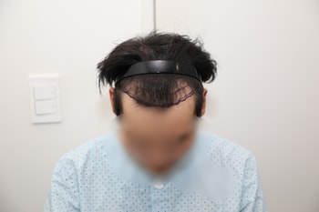 수술 전