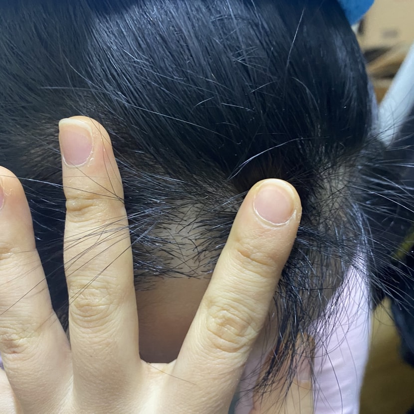 오른쪽 밀도는 대강 이런 느낌이에요 