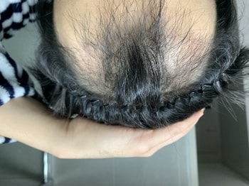 두달차