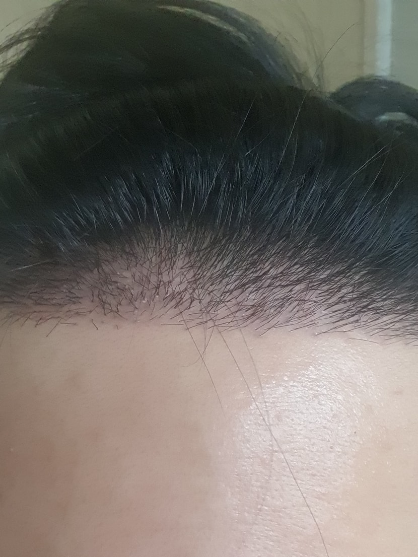 압면