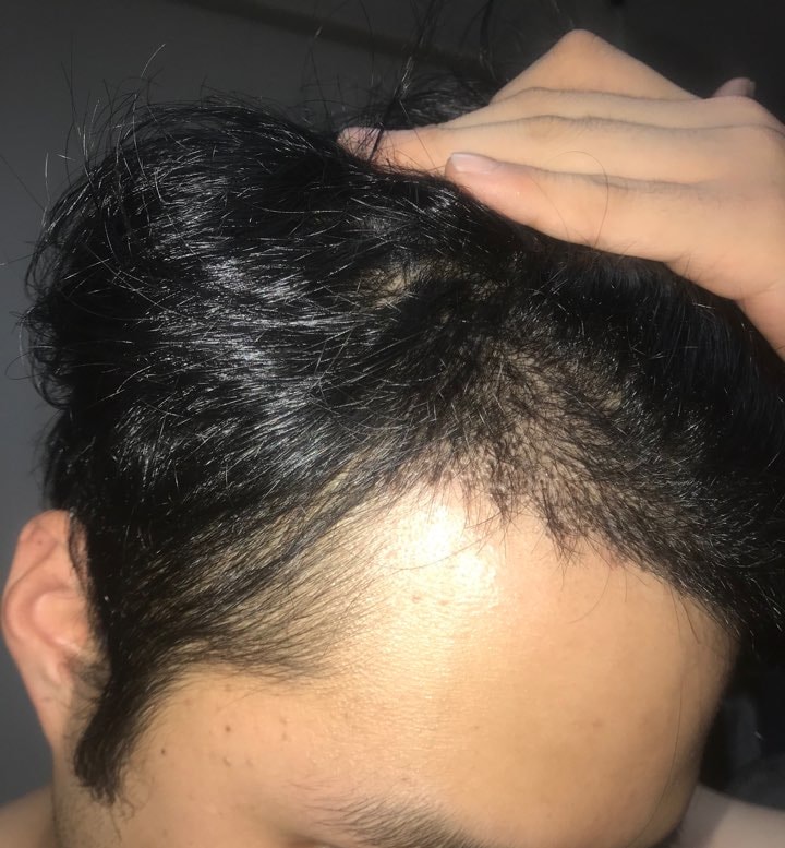 후레쉬 키고 찍은 왼쪽 사진