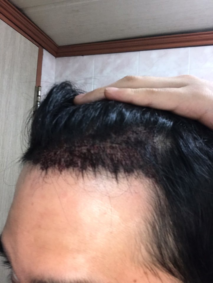 후레쉬 끄고 찍은 오른쪽 사진