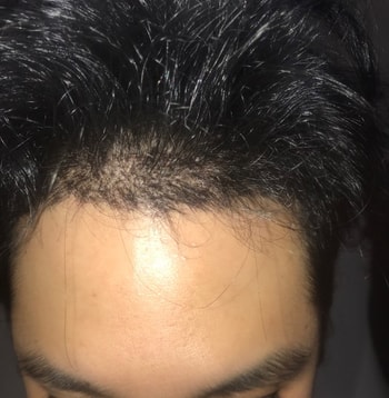 후레쉬 키고 찍은 사진 가운데 정면