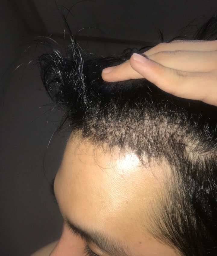 후레쉬 키고 찍은 오른쪽 사진