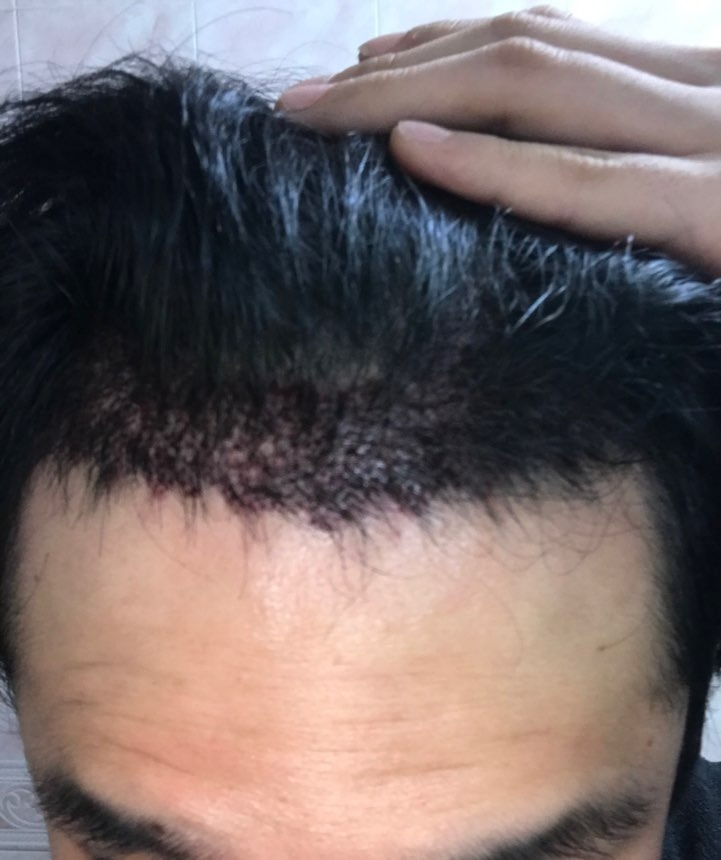후레쉬 끄고 찍은 사진 가운데 정면