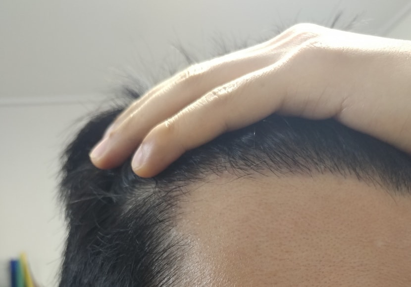오른쪽사진