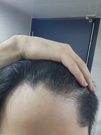 수술전이구요