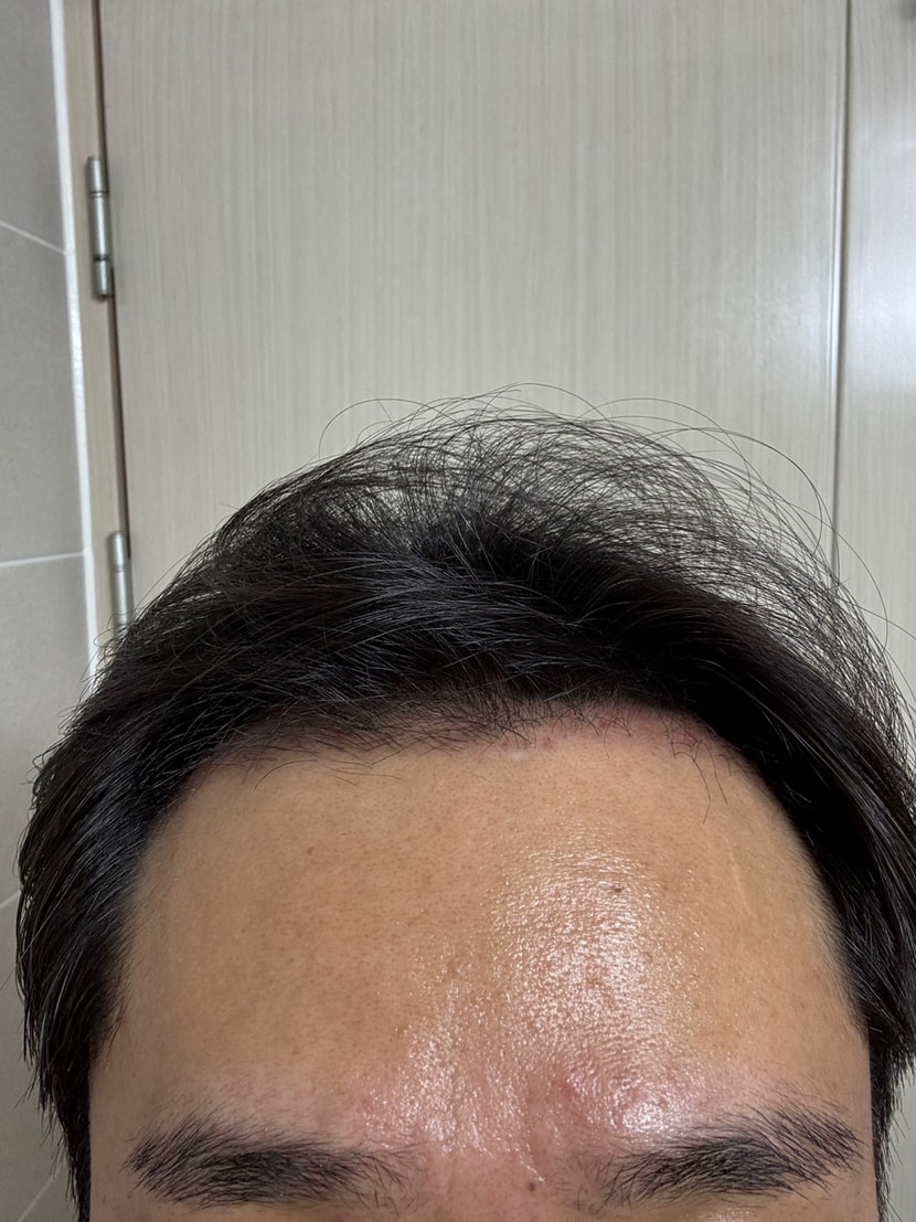 두달