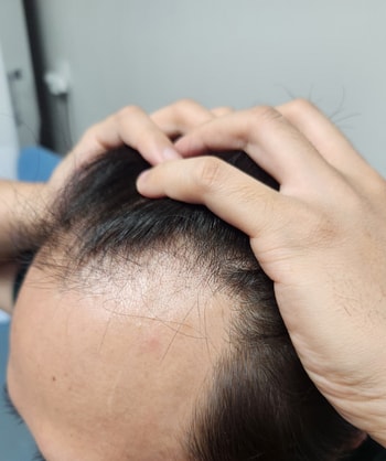 수술전