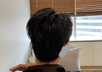 뒷머리 사진은 소독해주신 선생님께 부탁해서 찍었습니다