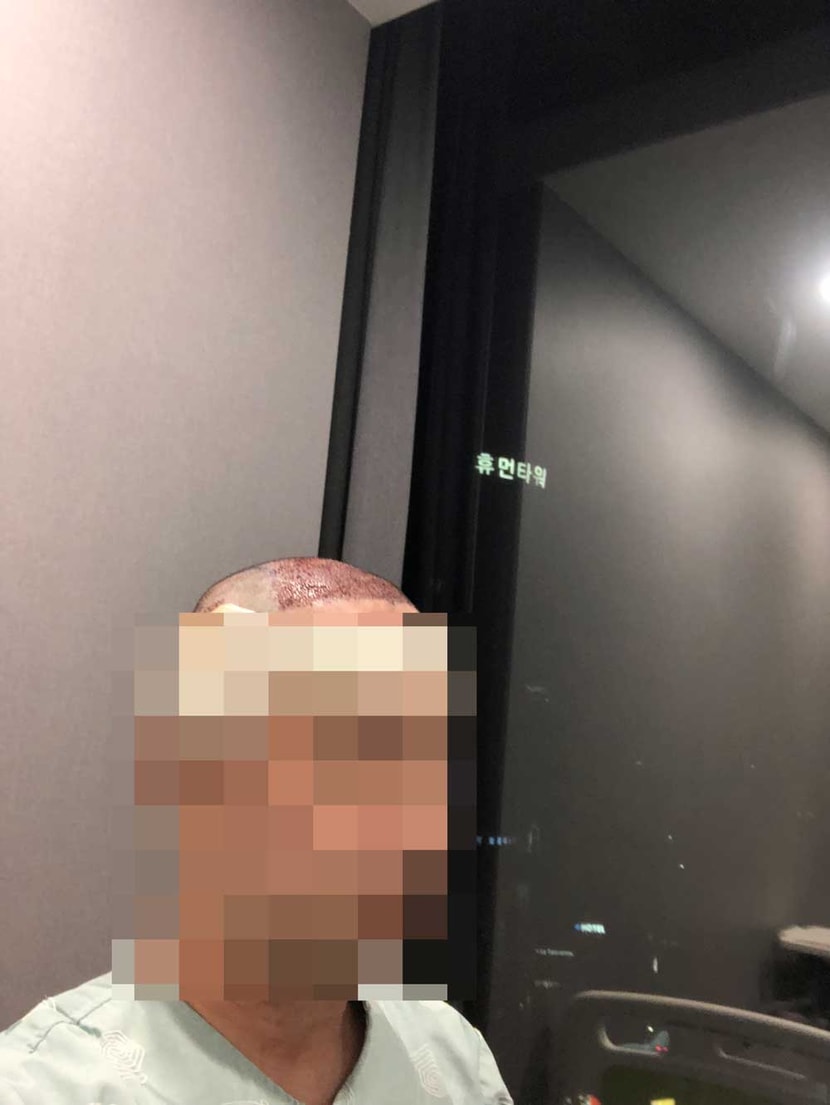 수술당일 입원실