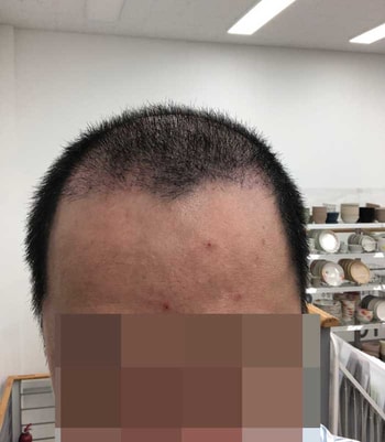 1개월차
