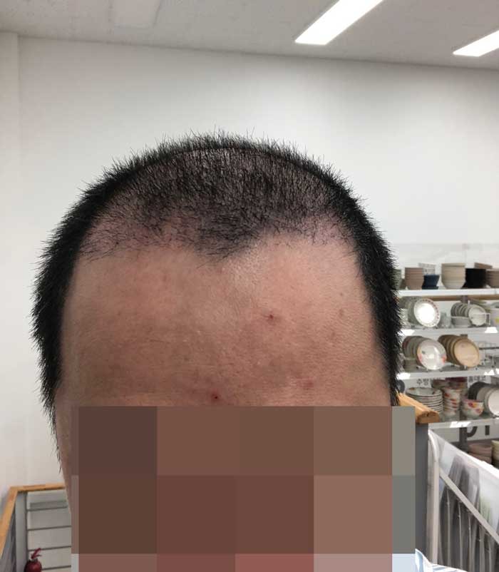 1개월차