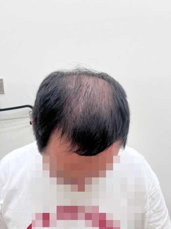수술전