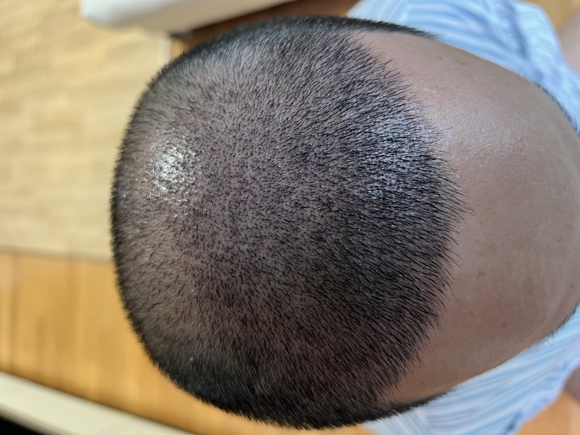 10일차