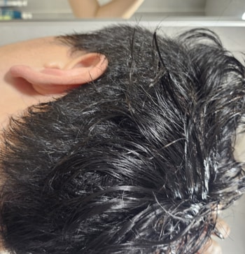 채취부위 안보임