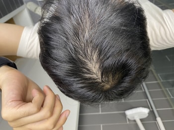 수술전