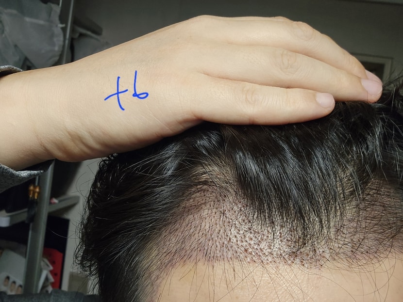 6일