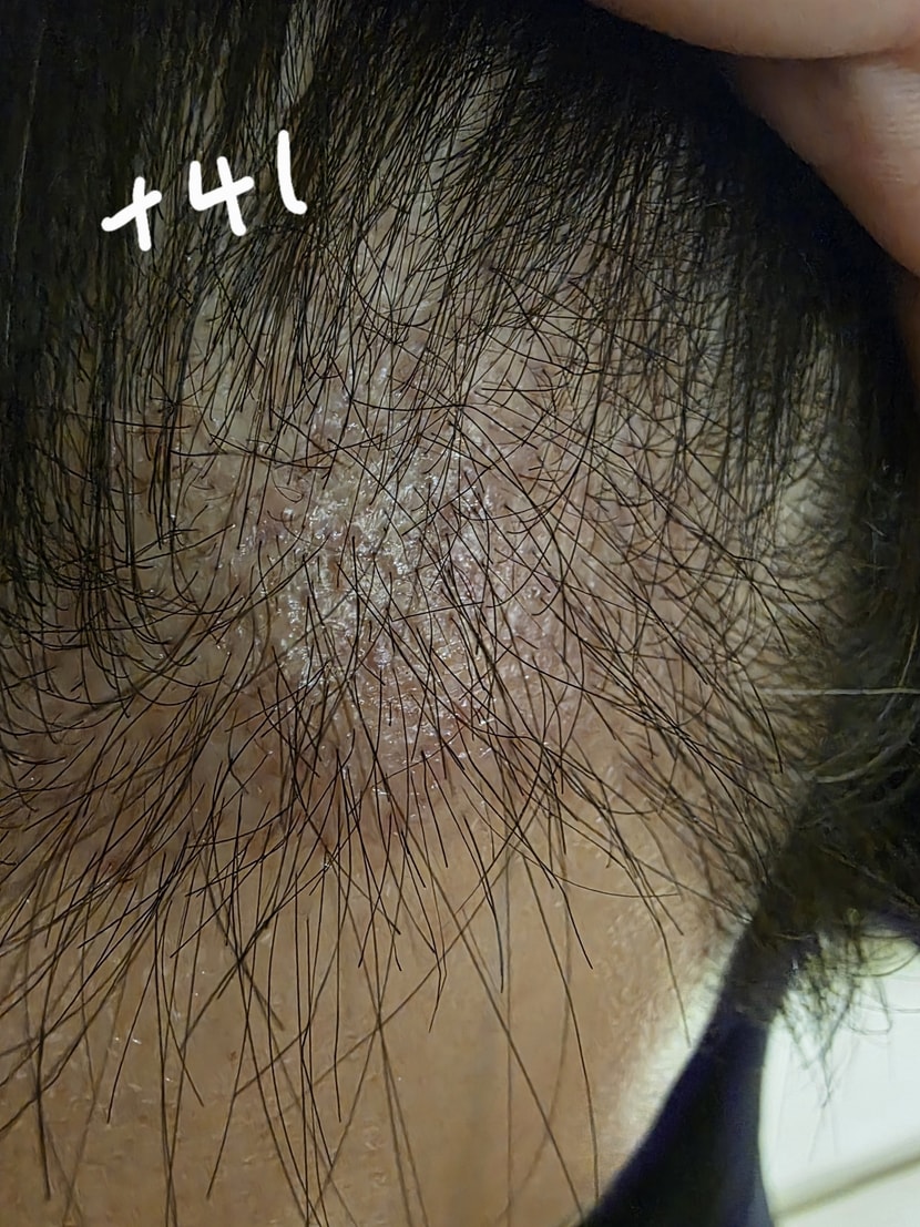 41일