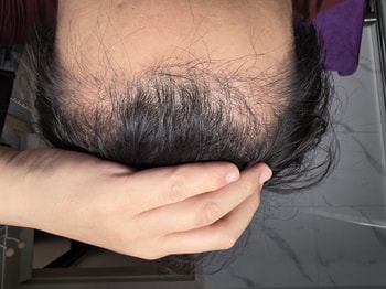 69일