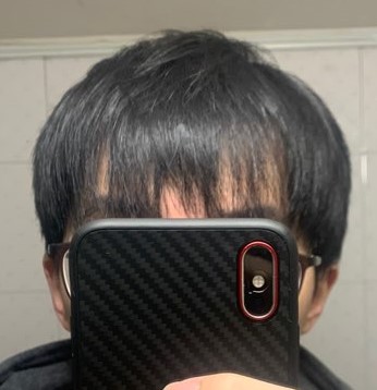 20년 현재 / 밀도