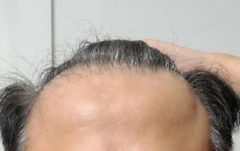 20개월 후