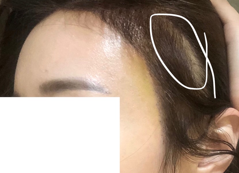보완했으면하는부분흰펜으로체크