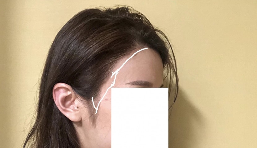 보완했으면하는부분흰펜으로체크