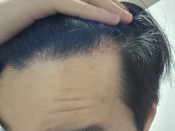 오른쪽