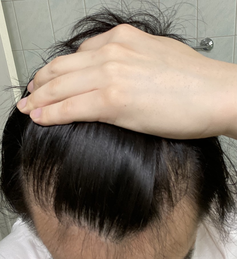 정면