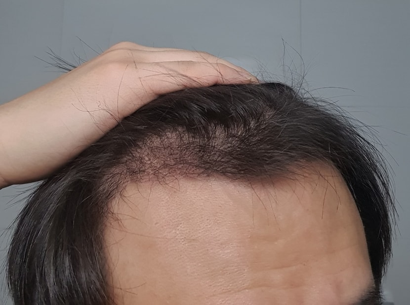 5개월차