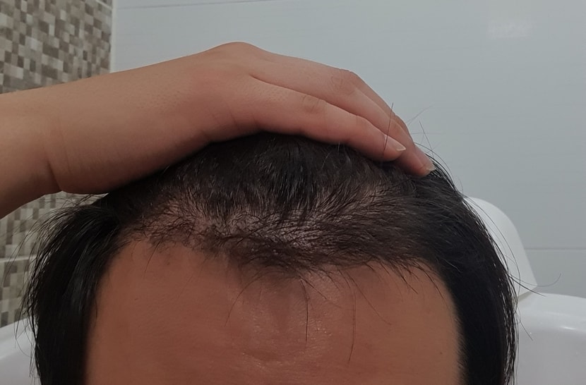 5개월차