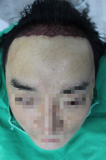 이식당일