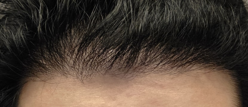 정면