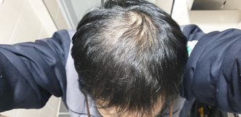 7개월후