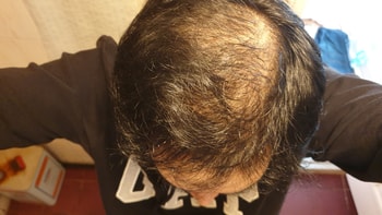 9개월후
