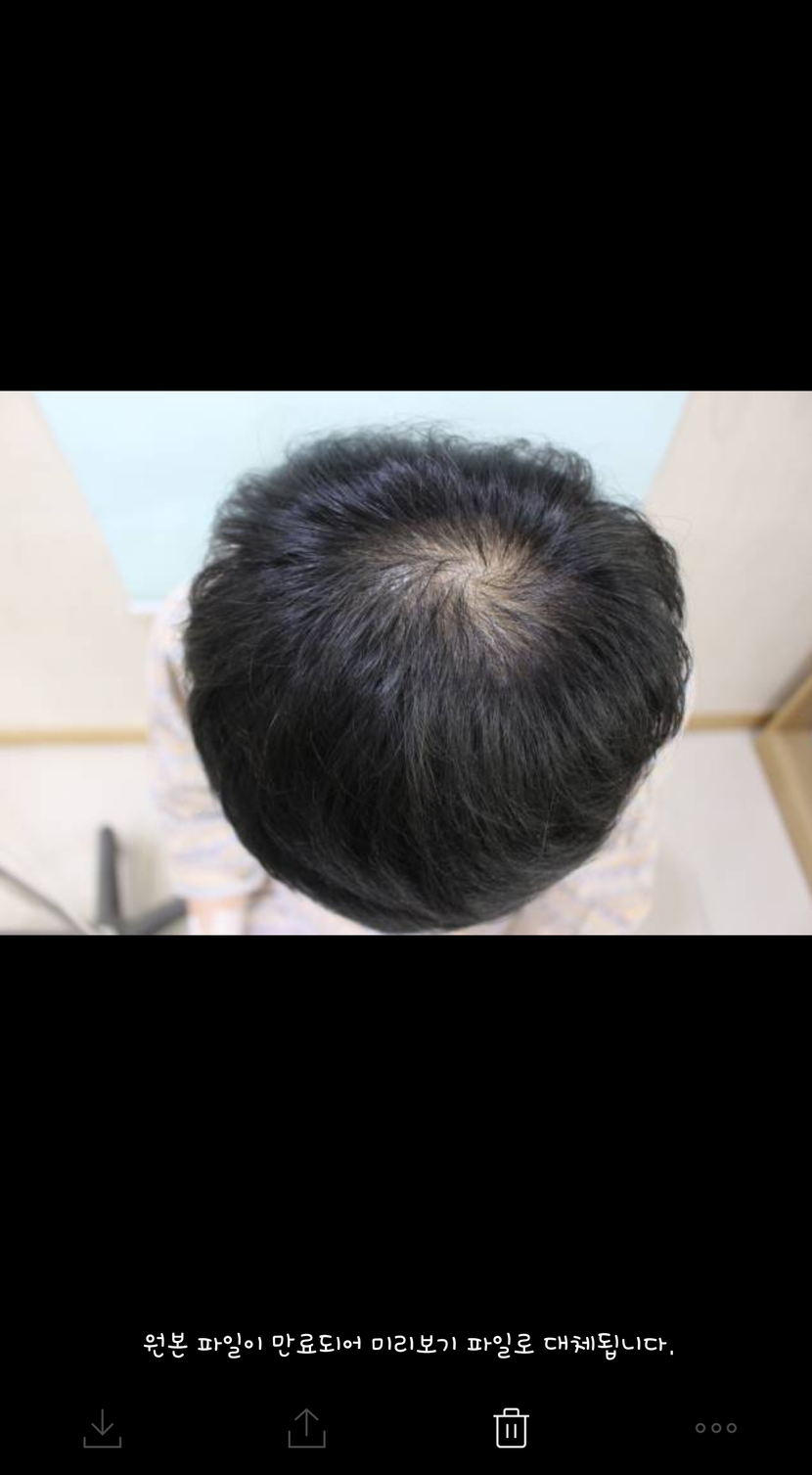 수술전