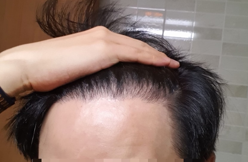 1년 4개월차 병원에서 찍는 머리띠 포즈로는 정상적으로 보입니다