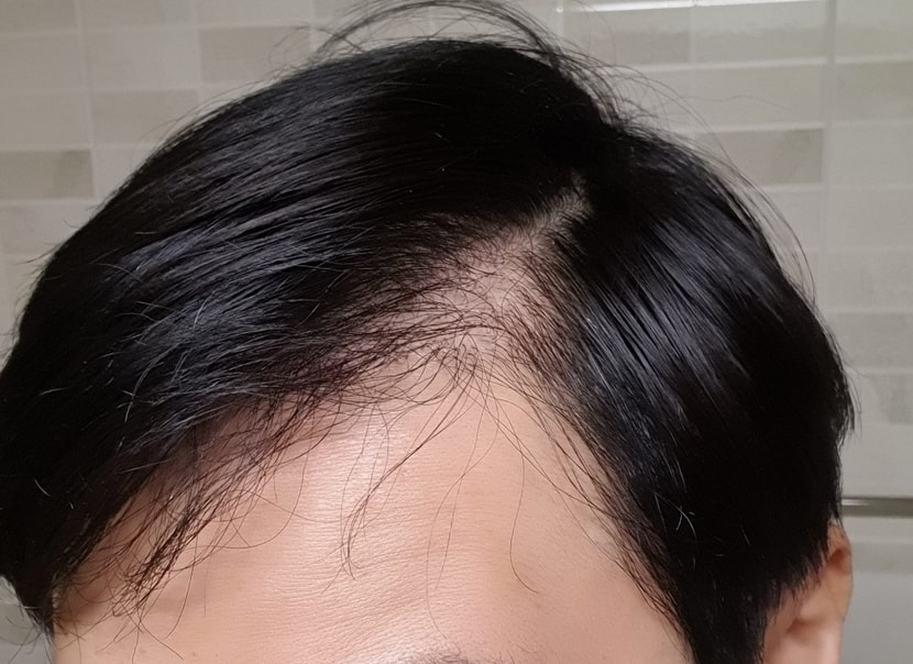 1년차 가르마오른쪽입니다