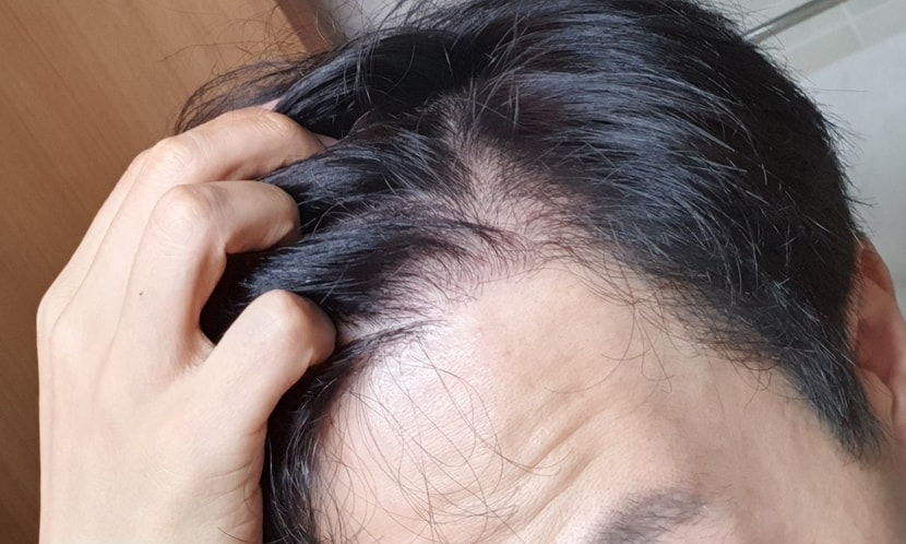 1년 4개월차 오른쪽
