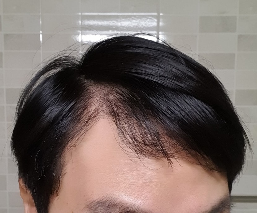 1년차 가르마왼쪽입니다
