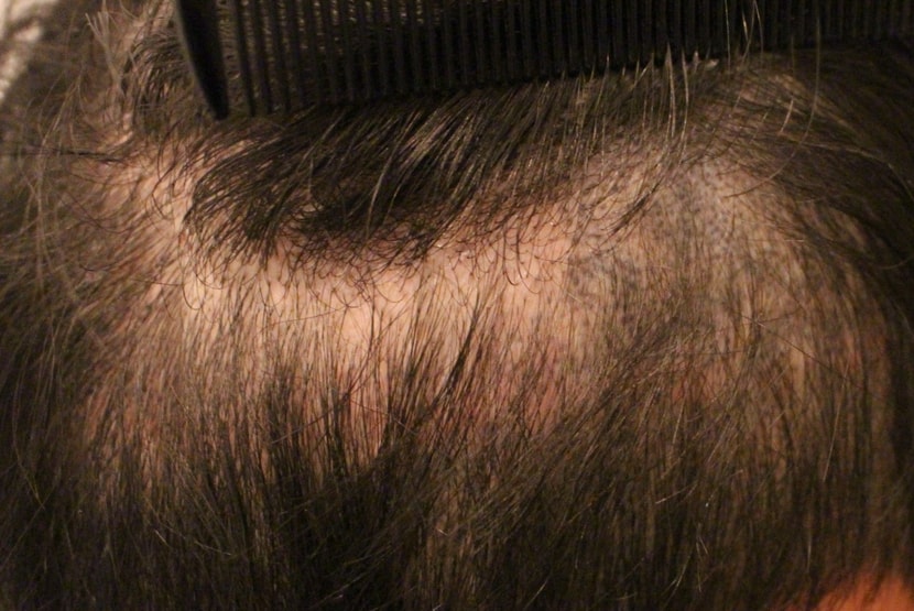 현재